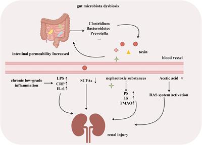 Gut microbiota microbial metabolites in diabetic nephropathy patients: far to go